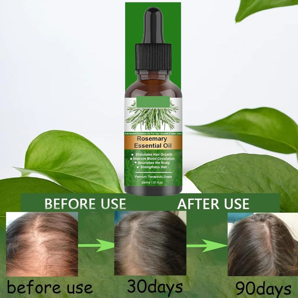 Rosemary Flourish Oil for Hair Growth 30ml  زيت إكليل الجبل لنمو الشعر 30 مل